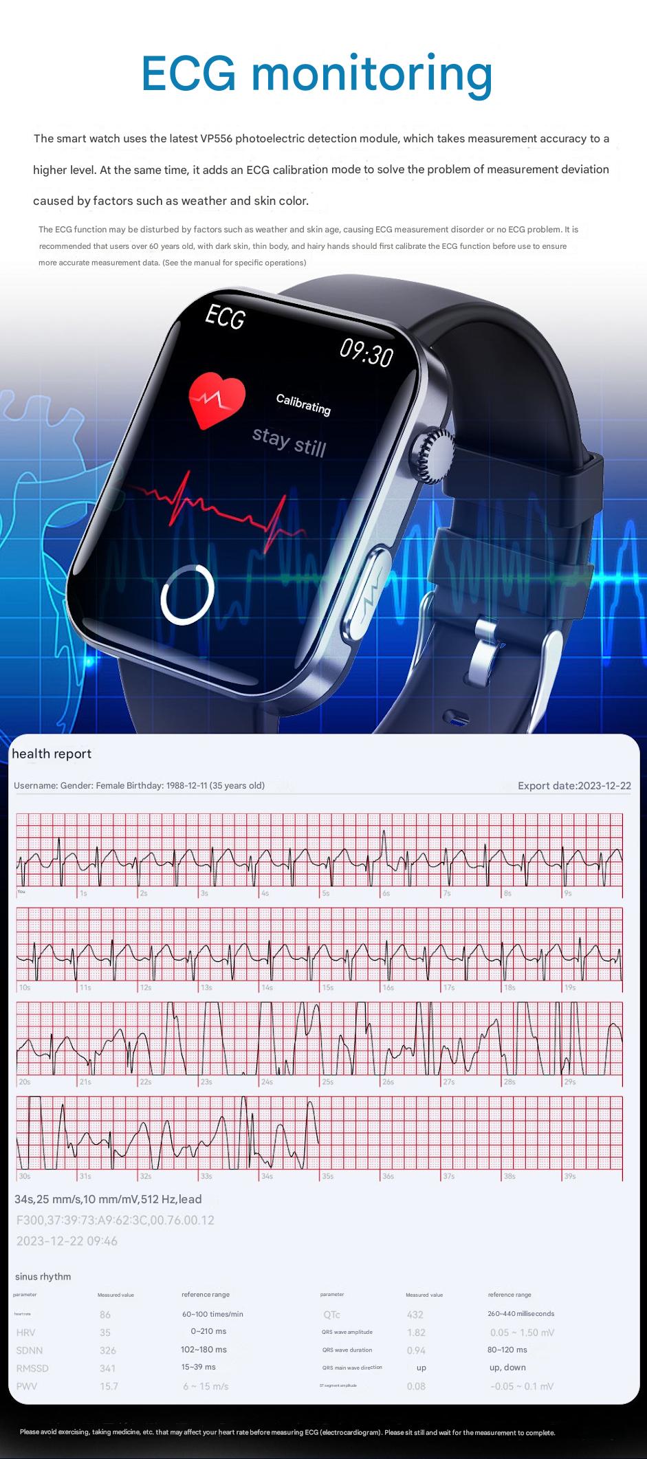 F300 smartwatch in lifestyle setting